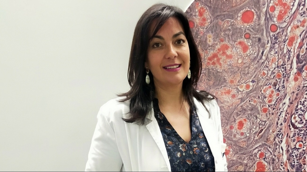 Ana Belén Crujeiras 